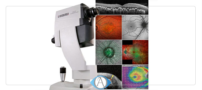 آنژیوگرافی چشم چیست ؟