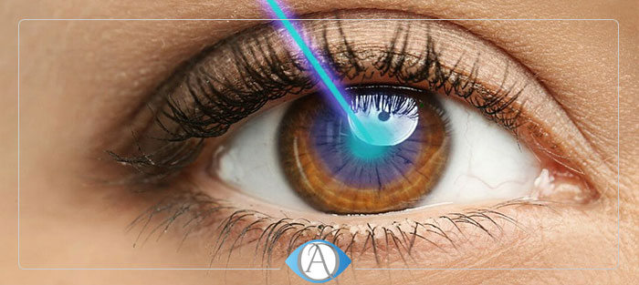 از خطرات و عوارض لیزیک چشم چه می دانید؟