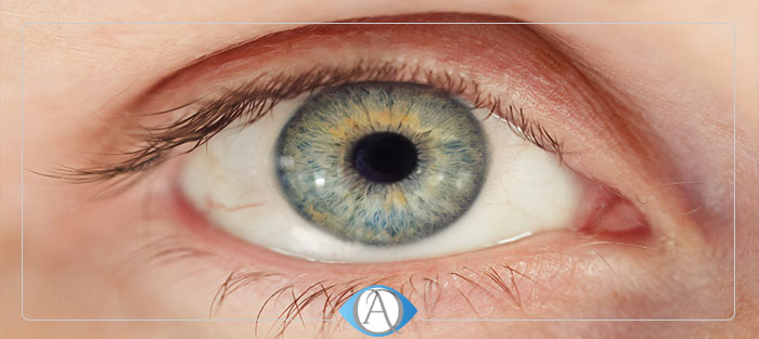 اصلی ترین دلیل بزرگی و گشادی مردک چشم چیست؟
