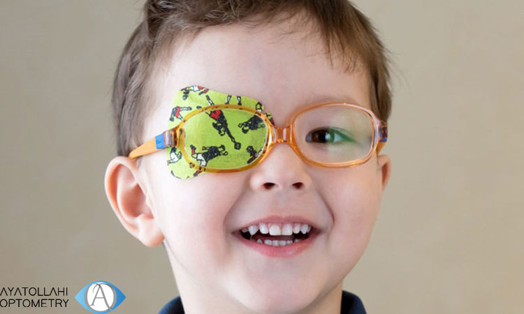 روش های درمان تنبلی چشم کودکان