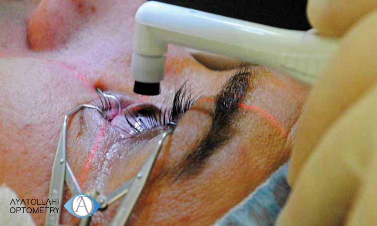 جراحی چشم برای بهبود بیماری تراخم