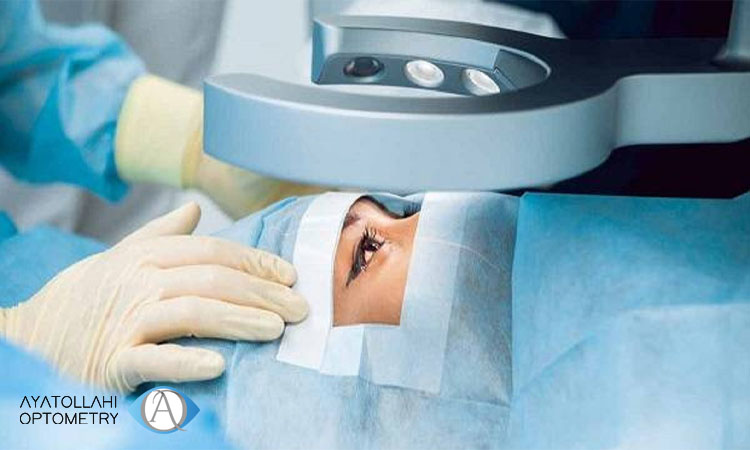 مراقبت های بعد ازجراحی لیزیک چشم