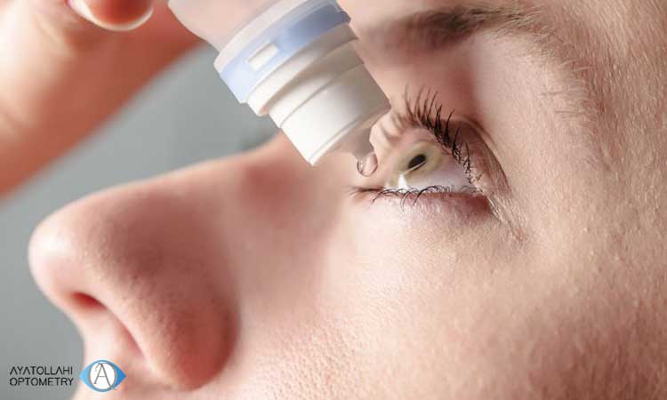قطره های کاهش دهنده التهاب چشم