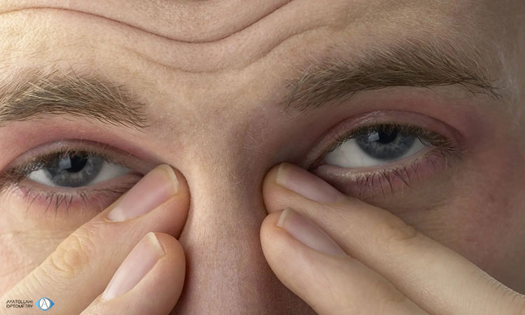 آلرژی چشم از دلایل سوزش چشم