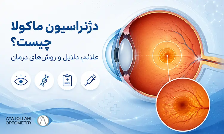 دژنراسیون ماکولا چیست