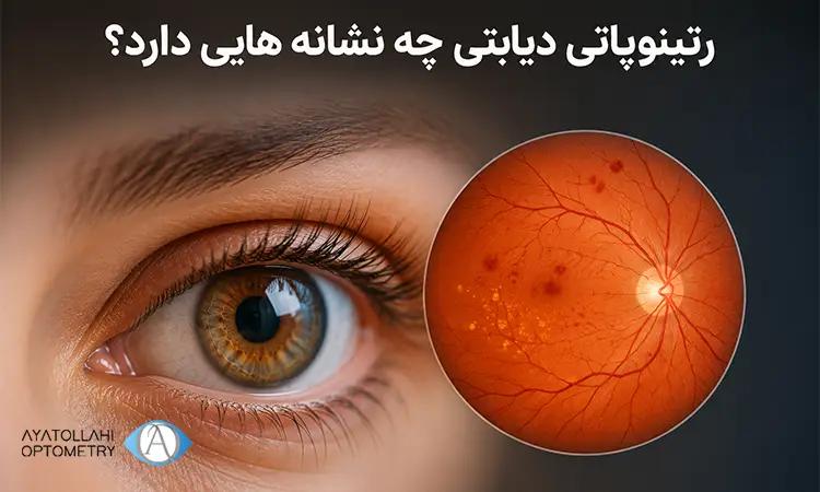 رتینوپاتی دیابتی چه نشانه هایی دارد؟