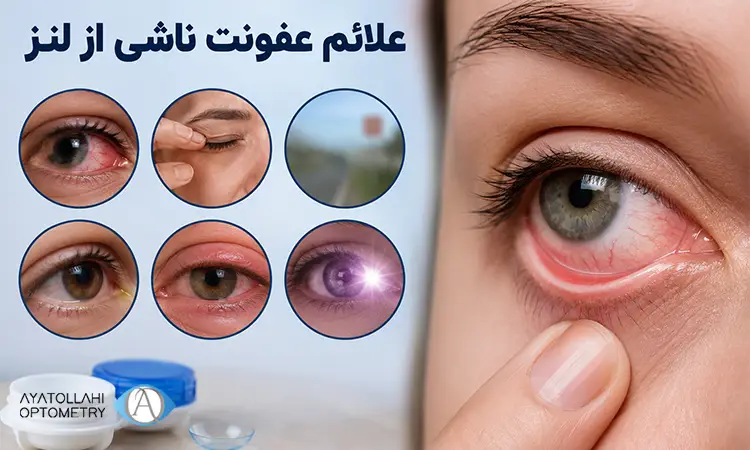 علائم عفونت ناشی از لنز