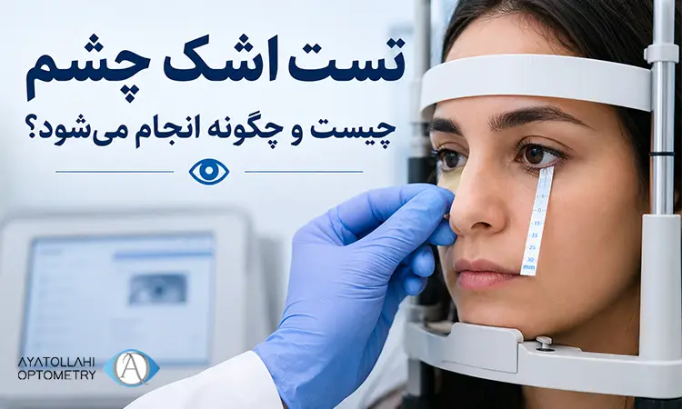 تست اشک چشم چیست