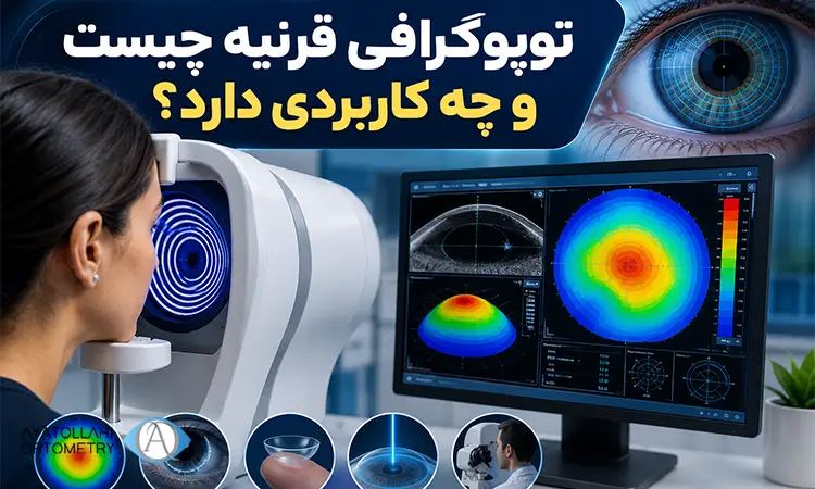 توپوگرافی قرنیه چیست و چه کاربردی دارد؟