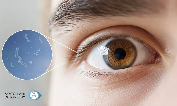 مگس پران طبیعی و علائم خطرناک شبکیه