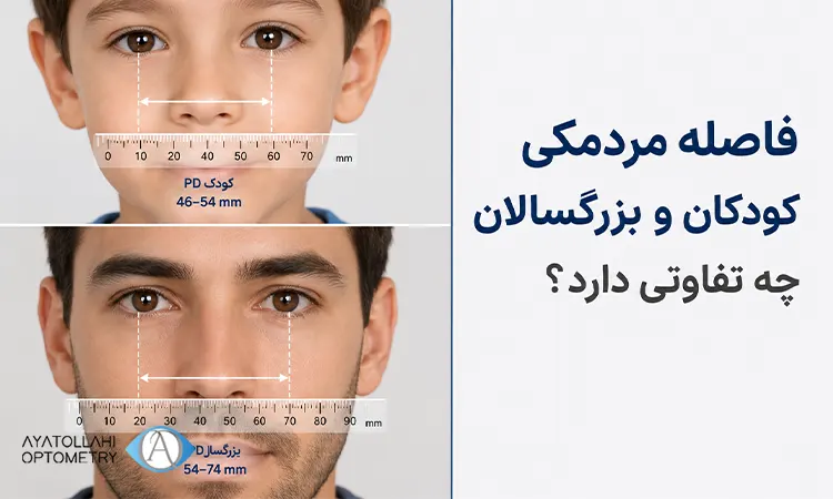 تفاوت فاصله مردمکی کودکان و بزرگسالان