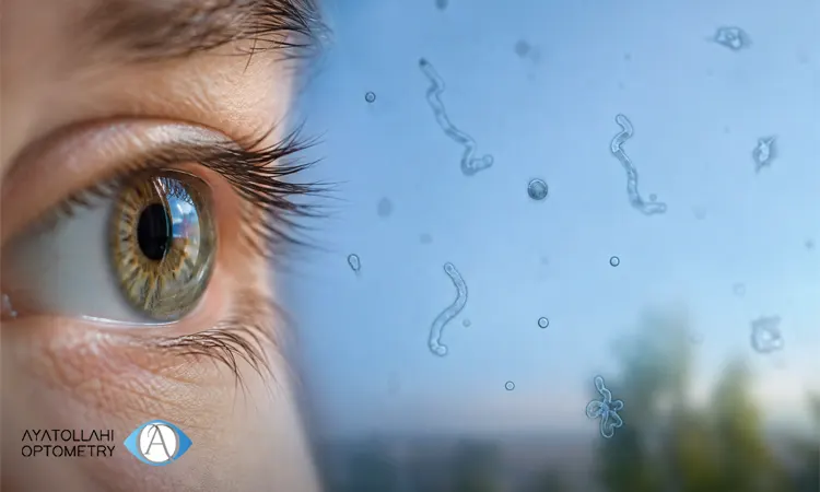 مگس پران چشم دقیقاً چیست