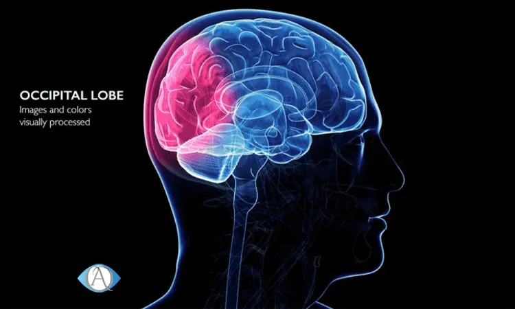 توضیح کم‌ بینایی ناشی از آسیب‌ های مغزی